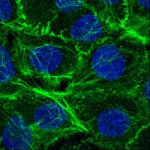 IBB-BSIRG_Actin fibers.lif_K_alphaB3_VN_3Snapshot1