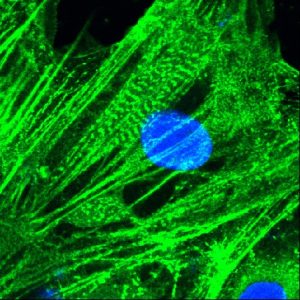 IBB-BSIRG_Actinina.lif_10_OLSnapshot1