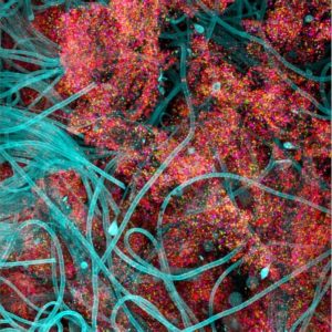 IBB-BSRG_Sponge microbiome FISH