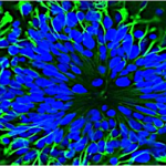 New Study Reveals Role of Extracellular Vesicle MicroRNAs in Brain Development and Rett Syndrome