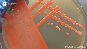 Discovering the Yeast Strain Rhodotorula taiwanensis: A Promising Biosurfactant Producer