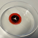 Electroresponsive hydrogels for insulin smart delivery