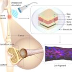 Stimuli-Responsive Gyroid Scaffolds: Hierarchical Architecture and Electric Stimulation Promote Bone Regeneration