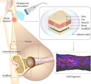 Stimuli-Responsive Gyroid Scaffolds: Hierarchical Architecture and Electric Stimulation Promote Bone Regeneration