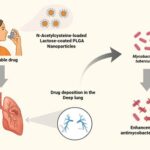 Inhalable N-Acetylcysteine-Loaded Lactose-Coated PLGA Nanoparticles for Tuberculosis Treatment