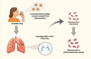 Inhalable N-Acetylcysteine-Loaded Lactose-Coated PLGA Nanoparticles for Tuberculosis Treatment