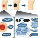 Self-Healing and Electroconductive Hydrogels for Wound Healing Published in Gels