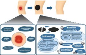 Self-Healing and Electroconductive Hydrogels for Wound Healing Published in Gels