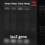 A Rapid In-Lab Toolbox for the Discrimination of Vibrio natriegens and Escherichia coli Cultures
