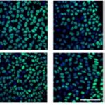 A stem cell-based toolkit to model Angelman Syndrome caused by paternal uniparental disomy of chromosome 15