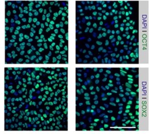 A stem cell-based toolkit to model Angelman Syndrome caused by paternal uniparental disomy of chromosome 15