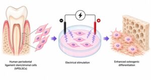 Electrical stimulation promotes the osteogenic differentiation of human periodontal ligament stem/stromal cells